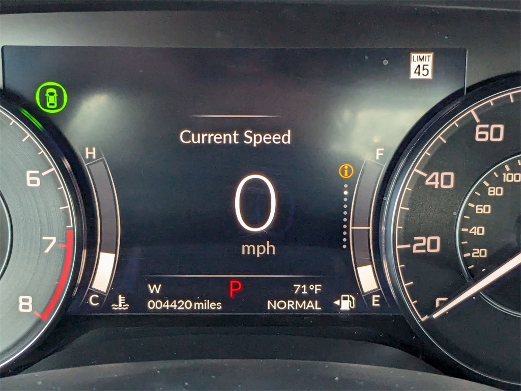 2023 Acura TLX Technology photo 17